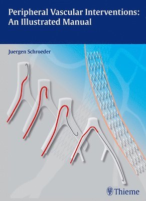 Peripheral Vascular Interventions: An Illustrated Manual 1
