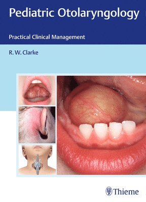 bokomslag Pediatric Otolaryngology