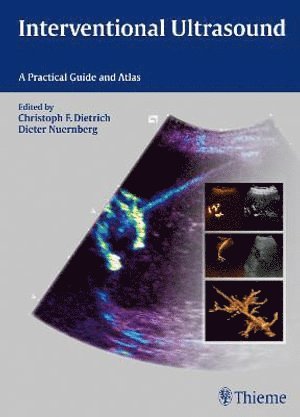 bokomslag Interventional Ultrasound