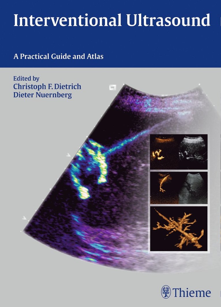 Christoph Frank Dietrich, Dieter Nürnberg - Interventional Ultrasound, Inbunden