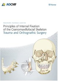 bokomslag Principles of Internal Fixation of the Craniomaxillofacial Skeleton