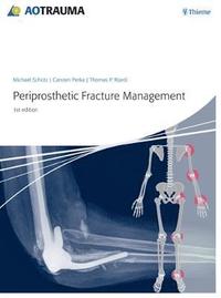 bokomslag Periprosthetic Fracture Management