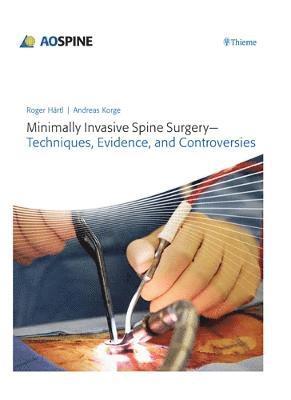 bokomslag Minimally Invasive Spine Surgery - Techniques, Evidence, and Controversies