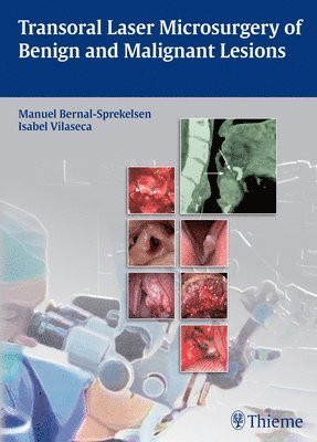 bokomslag Transoral Laser Microsurgery of Benign and Malignant Lesions