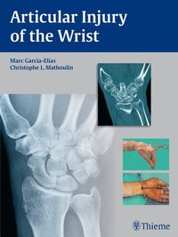 bokomslag Articular Injury of the Wrist