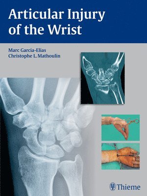 Articular Injury of the Wrist 1