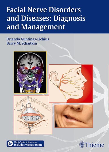 Orlando Guntinas-Lichius, Barry Schaitkin - Facial Nerve Disorders and Diseases: Diagnosis and Management, Inbunden