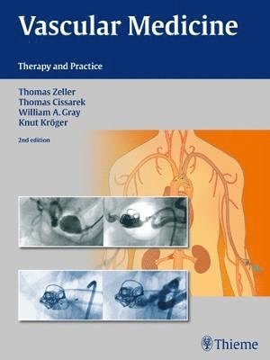 Thomas Zeller, Thomas Cissarek, William Gray, Knut Kröger, Knut Kroger - Vascular Medicine, Inbunden