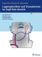 bokomslag Lappenplastiken und Transplantate im Kopf-Hals-Bereich