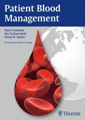 Hans Gombotz, Kai Zacharowski, Donat Rudolf Spahn - Patient Blood Management, Häftad