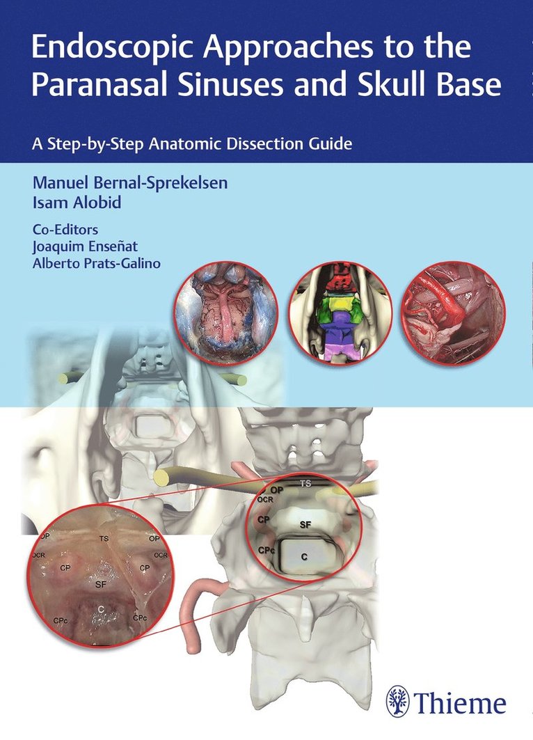 Endoscopic Approaches to the Paranasal Sinuses and Skull Base 1