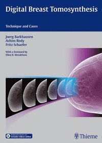 bokomslag Digital Breast Tomosynthesis