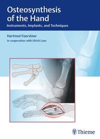 bokomslag Osteosynthesis of the Hand