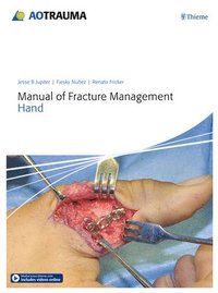 bokomslag Manual of Fracture Management - Hand