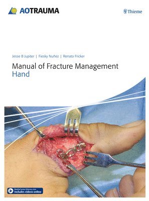 Manual of Fracture Management - Hand 1