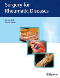 bokomslag Surgery for Rheumatic Diseases