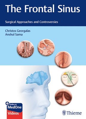 bokomslag The Frontal Sinus