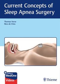 bokomslag Current Concepts of Sleep Apnea Surgery