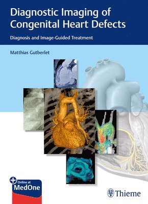 bokomslag Diagnostic Imaging of Congenital Heart Defects