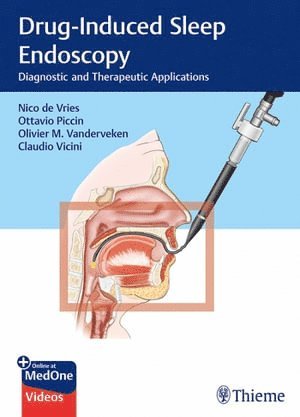 bokomslag Drug-Induced Sleep Endoscopy