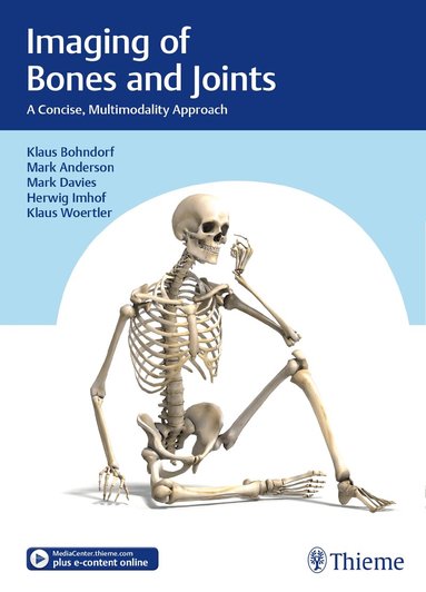 Klaus Bohndorf, Mark W. Anderson, Arthur Mark Davies, Herwig Imhof, Klaus Wörtler - Imaging of Bones and Joints, Inbunden