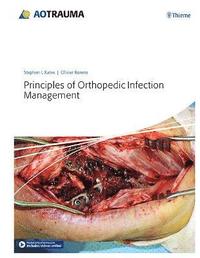 bokomslag Principles of Orthopedic Infection Management