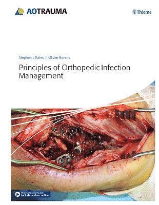 Principles of Orthopedic Infection Management 1