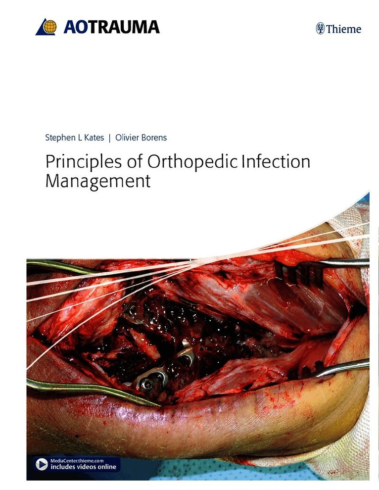 Stephen Kates, Olivier Borens - Principles of Orthopedic Infection Management, Inbunden