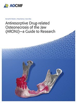 bokomslag Antiresorptive Drug-Related Osteonecrosis of the Jaw (ARONJ) - A Guide to Research