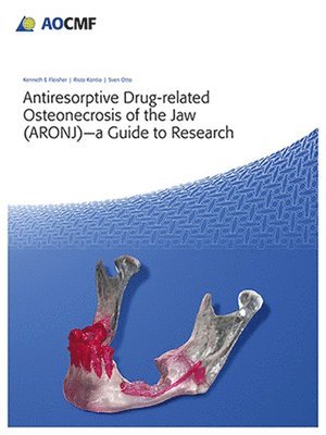 bokomslag Antiresorptive Drug-Related Osteonecrosis of the Jaw (ARONJ) - a Guide to Research