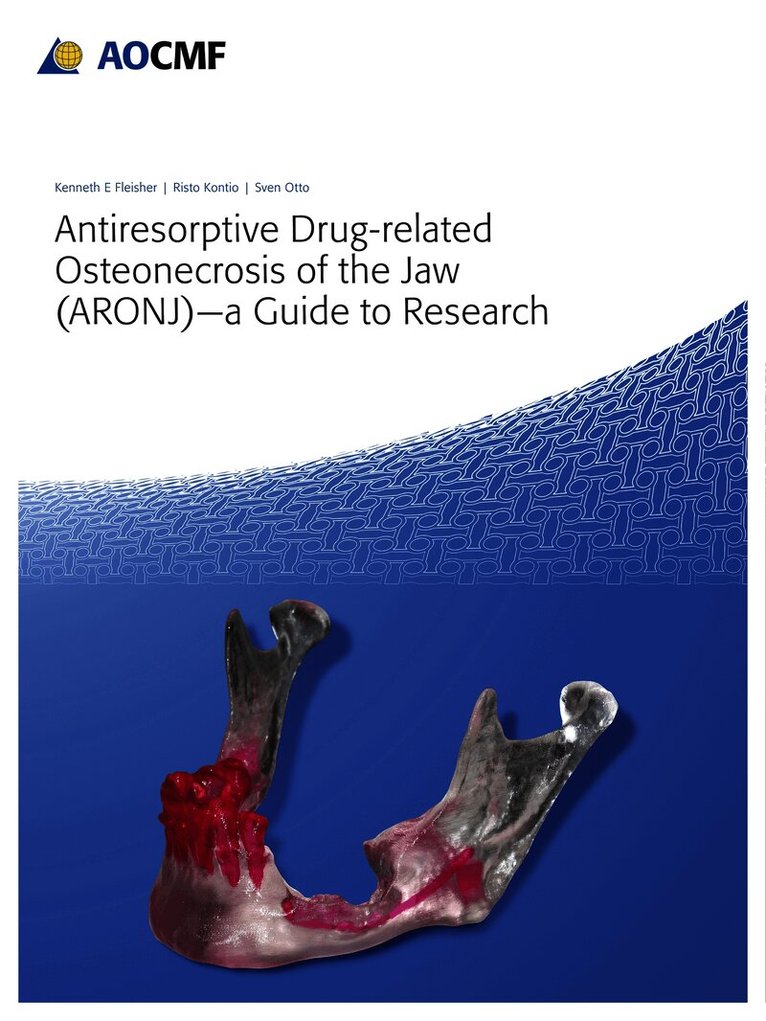 Antiresorptive Drug-Related Osteonecrosis of the Jaw (ARONJ) - a Guide to Research