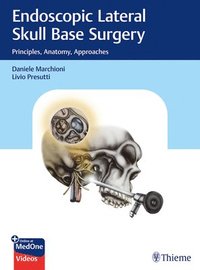 bokomslag Endoscopic Lateral Skull Base Surgery
