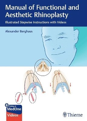 bokomslag Manual of Functional and Aesthetic Rhinoplasty