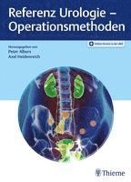 bokomslag Referenz Urologie - Operationsmethoden