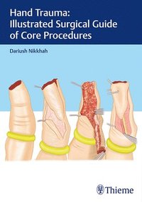bokomslag Hand Trauma: Illustrated Surgical Guide of Core Procedures
