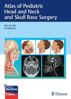 bokomslag Atlas of Pediatric Head and Neck and Skull Base Surgery