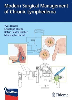 Modern Surgical Management of Chronic Lymphedema 1