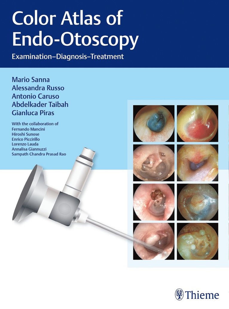 Mario Sanna, Alessandra Russo, Antonio Caruso, Abdelkader Taibah, Gianluca Piras - Color Atlas of Endo-Otoscopy, Inbunden