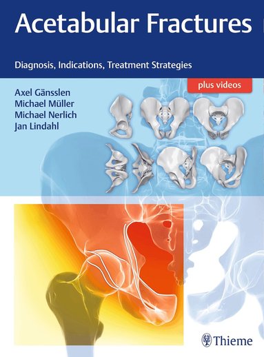 Axel Gänsslen, Michael Müller, Michael Nerlich, Jan Lindahl - Acetabular Fractures, Inbunden