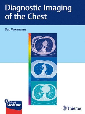 bokomslag Diagnostic Imaging of the Chest