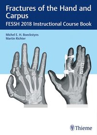 bokomslag Fractures of the Hand and Carpus