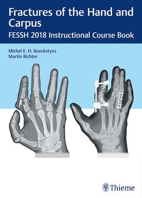 bokomslag Fractures of the Hand and Carpus