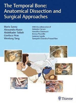 Mario Sanna, Alessandra Russo, Abdelkader Taibah, Gianluca Piras, Wenlong Tang - Temporal Bone, Inbunden
