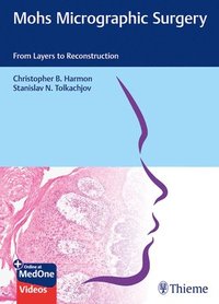 bokomslag Mohs Micrographic Surgery: From Layers to Reconstruction