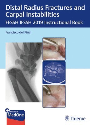 bokomslag Distal Radius Fractures and Carpal Instabilities