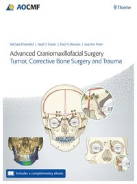 bokomslag Advanced Craniomaxillofacial Surgery