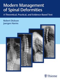 bokomslag Modern Management of Spinal Deformities