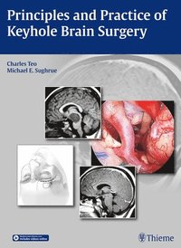 bokomslag Principles and Practice of Keyhole Brain Surgery