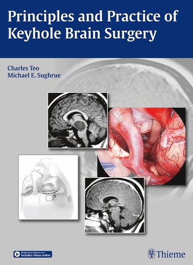 Charles Teo, Michael E. Sughrue - Principles and Practice of Keyhole Brain Surgery, Inbunden