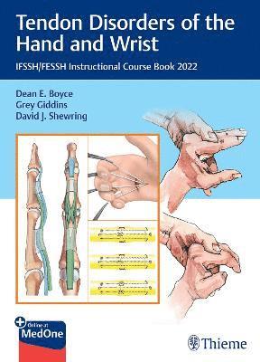 Tendon Disorders of the Hand and Wrist 1